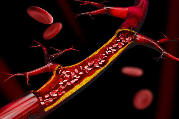 Representação dos vasos sanguíneos, responsáveis por transportar o sangue pelo corpo no sistema cardiovascular.